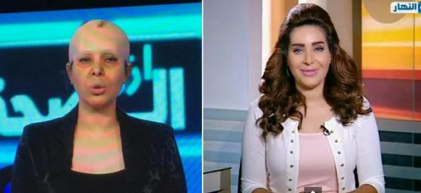 مذيعة مصرية تثير سخط مواقع التواصل بسبب طريقة تضامنها مع مرضى السرطان