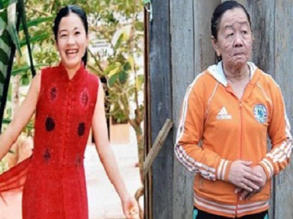 فيتنامية أصبحت عجوزًا في غضون أيام قليلة 