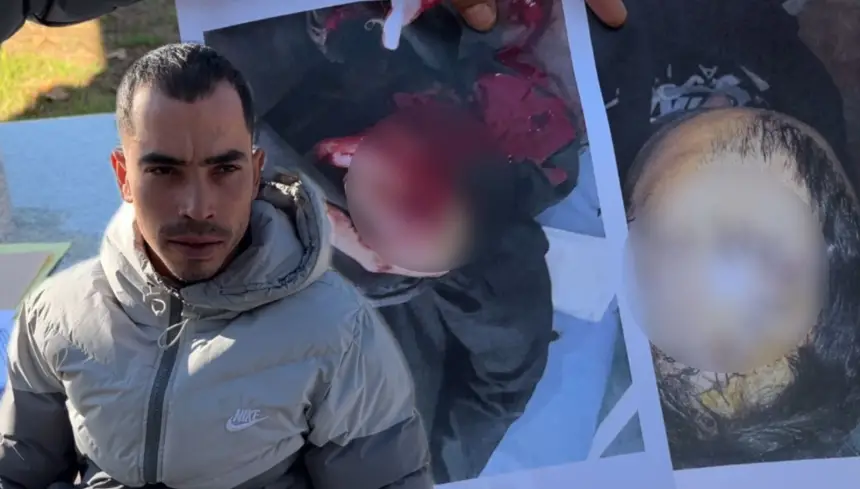 عاهة مستديمة لشاب بفاس بعد اعتداء بالسلاح الأبيض