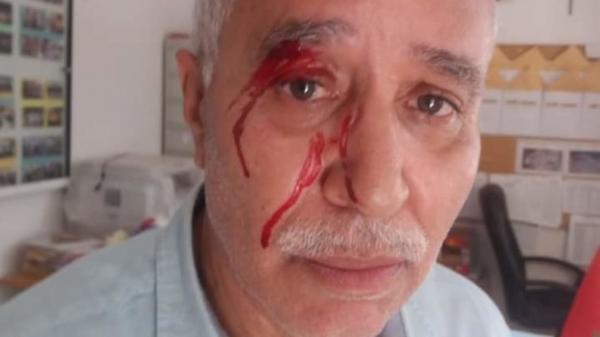 الأمن يعتقل والدة التلميذ التي اعتدت على مُدير مدرسة بطنجة