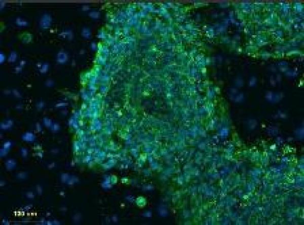محكمة امريكية تؤيد تمويل ابحاث الخلايا الجذعية للاجنة