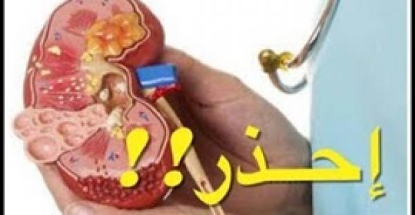 بالفيديو.. 5 عادات سيئة تؤذي الكليتين