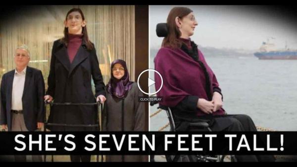 بالفيديو: تعرف على الشابة العملاقة التي لا تتوقف عن النمو