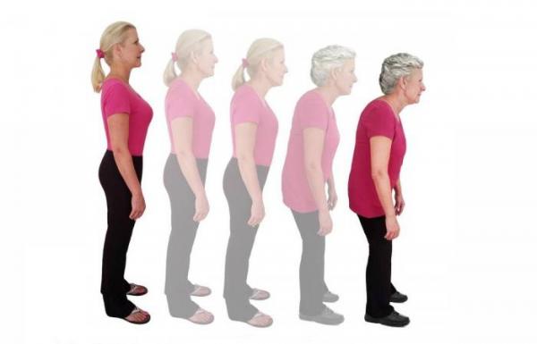 أسباب رئيسية لتناقص طول القامة مع التقدم في العمر