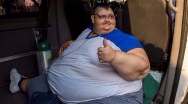 مكسيكي وزنه 600 كيلوغرام يخضع لعملية تصغير معدة