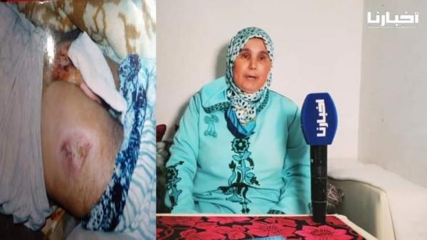 مغربية مقهورة: راجلي عامل في البناء وقعتلو حادثة وخلاواه حتى "تعفن لحمه" وتوفى والمقاول معقلش عليه