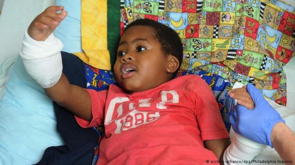 نجاح أول عملية زرع يدين لطفل