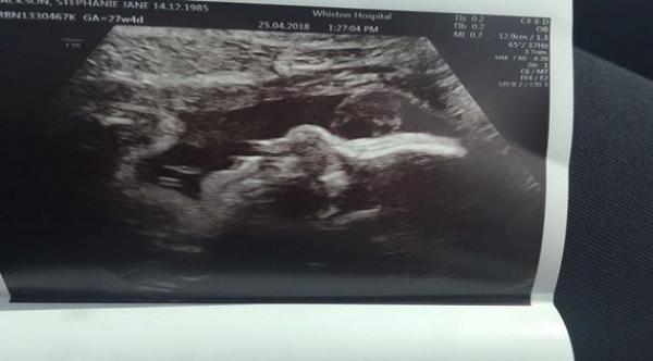 تشاهد وجه جدتها الراحلة في صورة الجنين