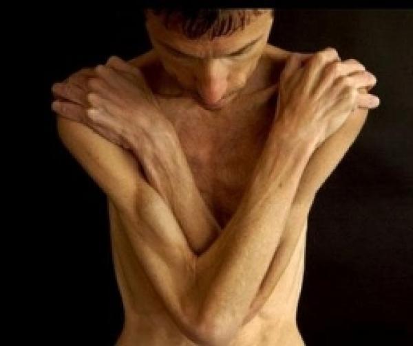 ما أفضل الأنظمة الغذائية لعلاج النحافة