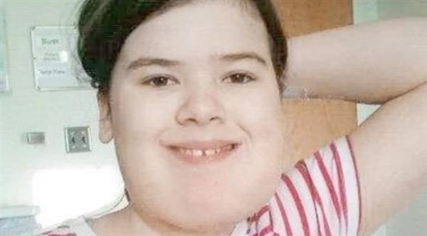 انتفاخ في الوجه يكلف مراهقة 55 عملية جراحية