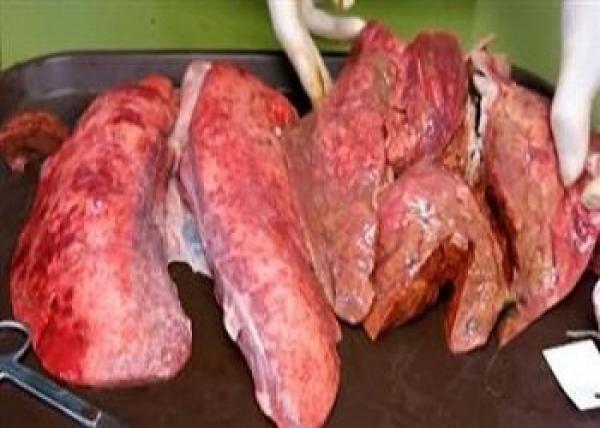 هذا ما يحدث للرئة بعد 60 سيجارة...فهل تقلع؟