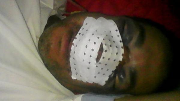 بلطجية المدار السياحي ببني ملال  يشرملون صحفيا ونقابيا وحالة الأخير حرجة