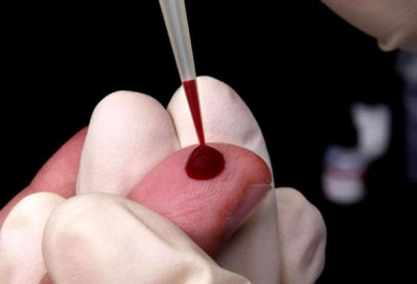 حلّل خرف الشيخوخة باختبار الدم