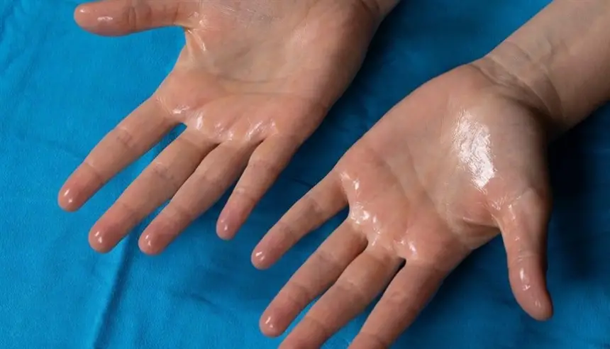 التعرق المفرط قد يكشف عن مشكلات صحية خطيرة: متى يصبح مدعاة للقلق؟