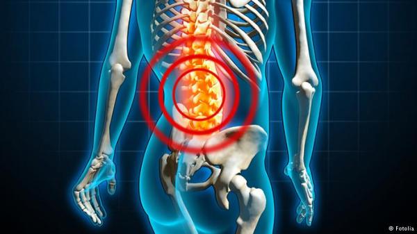 الأطباء يحددون العادات التي تؤثر سلبيا على قامة الإنسان