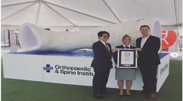 مستشفى يدخل موسوعة غينيس بأكبر جبيرة عظمية في العالم