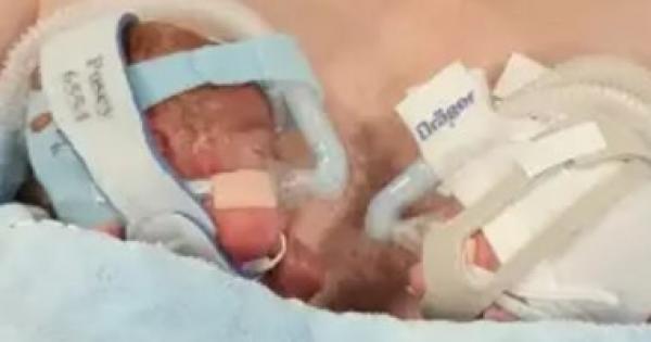 رضيعان بريطانيان يكافحان للبقاء على قيد الحياة بعد ولادتهما في الشهر 6