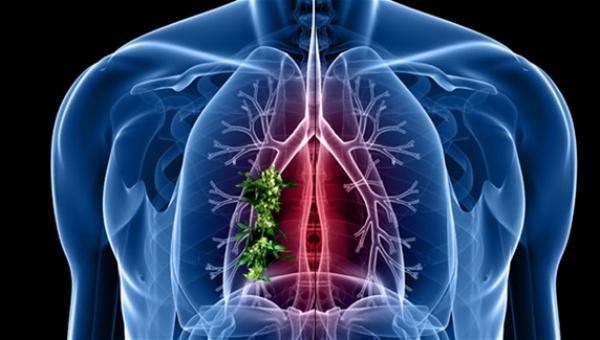 ابتلع بذرة... فأنبتت في رئتيه