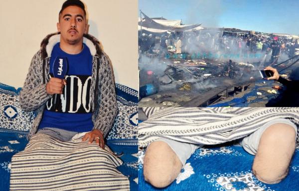 واش هذا حق: مهدي شاب تقطعو ليه رجليه بـ2 في انفجار قنينة غاز ومن بعد الحادث غدي يتلقى أكبر صدمة في حياتو (فيديو)