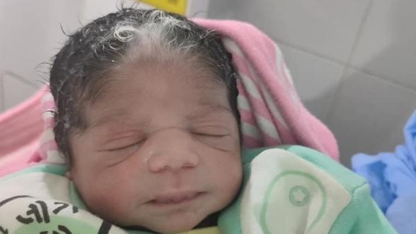 من بينها طفلة بدون جلد...طبيب يحذر من ارتفاع عدد "الولادات الغريبة" بمصر ويكشف عن الحالات الصادمة التي عاينها