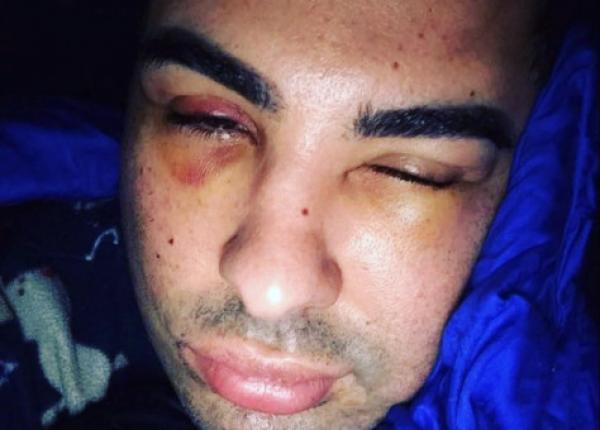 "دوك صمد" يكشف عن تفاصيل جديدة حول الاعتداء الشنيع الذي تعرض له وهذا ما قاله له المعتدون