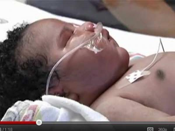 ولادة طفل ضخم بأمريكا