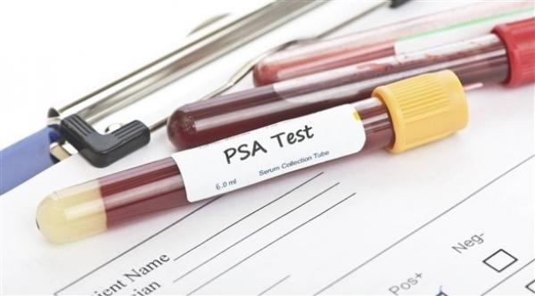 بداية من 45 عاماً...نصائح حول فحص البروستاتا مرة واحدة في العام