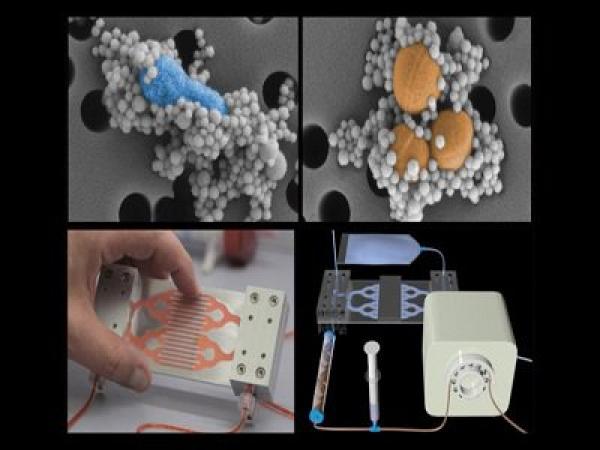 العلماء يطورون طحالا اصطناعيا يمكنه تنقية الدم من فيروسات شديدة الخطورة