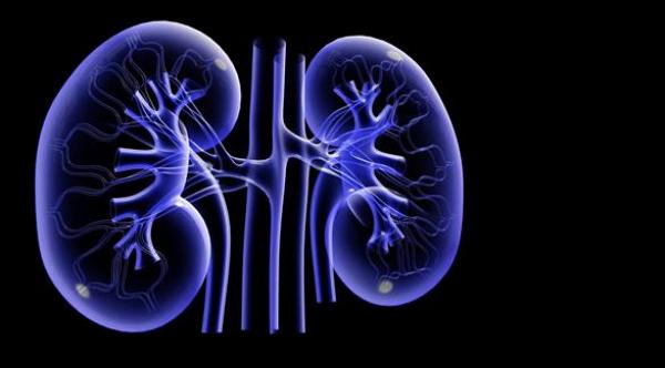 تجنب هذه الأطعمة للوقاية من حصى الكلى