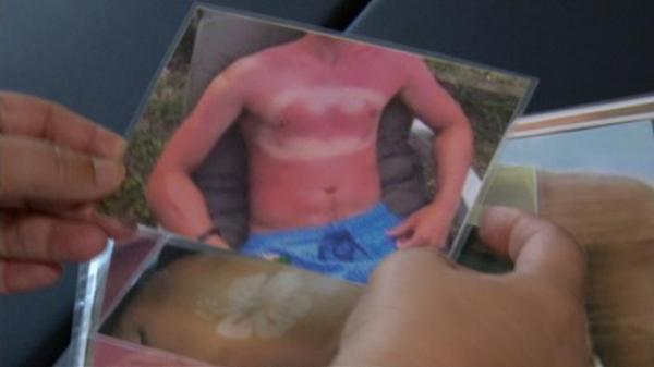 وشم الشمس.. صيحة جديدة قد تنتهي بالوفاة