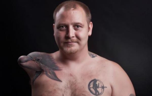 رجل فقد ذراعه وحوله على شكل دولفين  