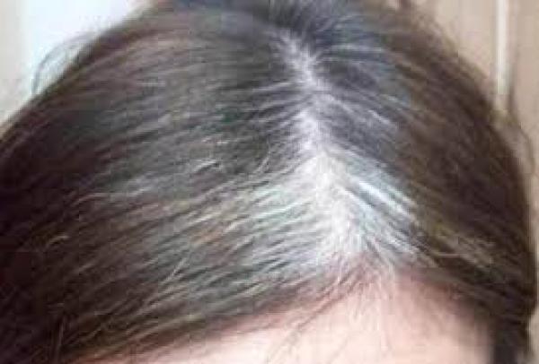نصائح لمنع ظهور الشعر الأبيض مبكرا