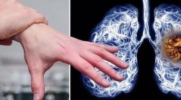 تضخم الأصابع .. مؤشر على الإصابة بمرض خطير