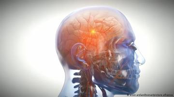 علماء يسجلون نشاطاً غامضاً بأدمغة أشخاص أثناء وفاتهم