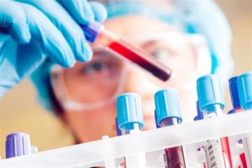 شركة بريطانية تنجح في ابتكار اختبار دم يتنبأ بالسرطان مبكرا