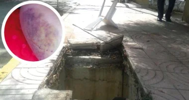 بعد سقوطها  في بالوعة للصرف الصحي فتاة تقرر مقاضاة مسؤولي جماعة سيدي حرازم