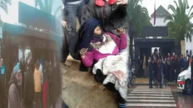 هذا جديد الحالة الصحية للموظفة التي اضرمت النار بجسدها بسيدي مومن!!
