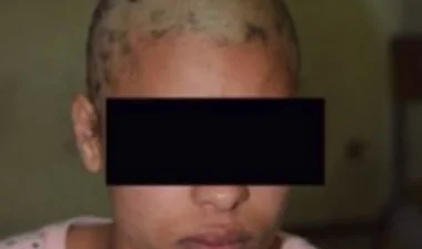 أحكام سجنية صارمة في حق المعتدين على النادلة شيماء و هذه قيمة التعويض المادي الذي ستحصل عليه 