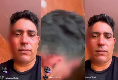 فنان راب شهير يفاجئ جمهوره بسرد وقائع تعرضه لاعتداء دموي