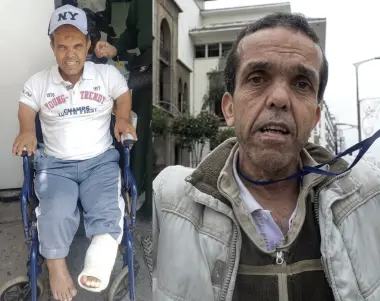 حادث سير قلب حياته رأسا على عقب.. ناصري يفتح ملف معاناة الجيلالي بوسكة عبر نداء تضامني