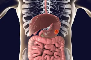 ميكروبيوم الأمعاء... الحارس الخفي لصحتنا الجسدية والنفسية