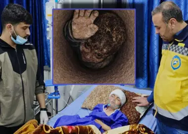 في حادثة شبيهة بـ “ريان”.. الدفاع المدني السوري ينقذ طفلا من بئر بعمق 30 مترا