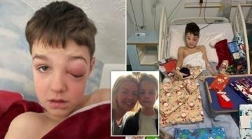 أعراض نادرة لفيروس كورونا تتسبب لطفل بالعمى المؤقت