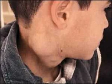 المندوب الإقليمي للصحة بتنغير يُوضح لـ "أخبارنا المغربية" طبيعة المرض الذي أصاب بعض التلاميذ بـ" تيمضرت" وشكل التدخل
