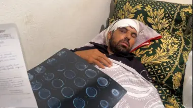 خطير.. فلاح من إقليم تاونات ينجو من الموت بعد تعرضه لهجوم من أقاربه