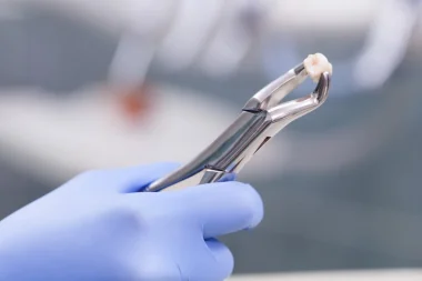 رجل عانى عامين بسبب نمو سن في مكان لم يخطر بباله