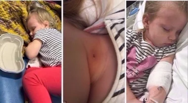 طفلة تُصارع الموت بسبب خدش قطة...احذروا
