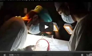 بالفيديو: عملية قلب مفتوح على ضوء هاتف محمول