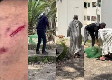 تدخل غير متوقع.. فقيه ينهي فوضى كلبة عضت عشرات الأشخاص بتازة