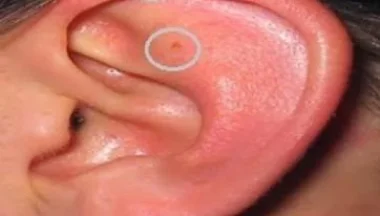 اكتشاف أول طريقة لمعرفة "عذرية الرجال"